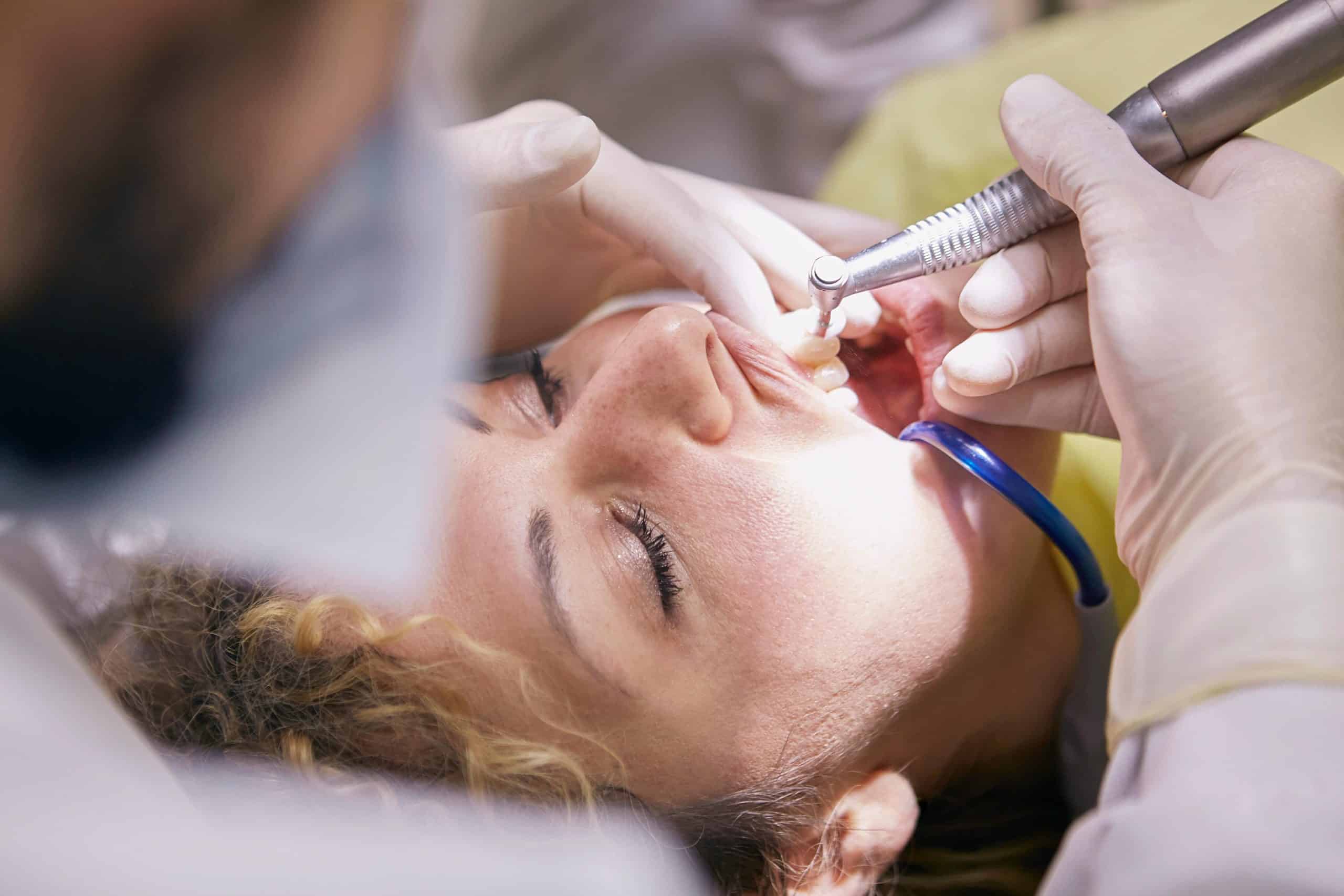 Close-up of a woman undergoing dental drilling by a dentist in dental office.